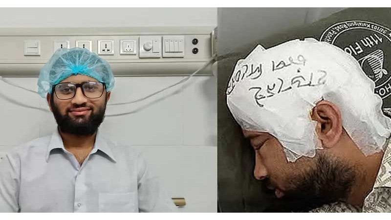 ফ্রিজে রাখা খুলি দুই মাস পর বসল চবি শিক্ষার্থীর মাথায়